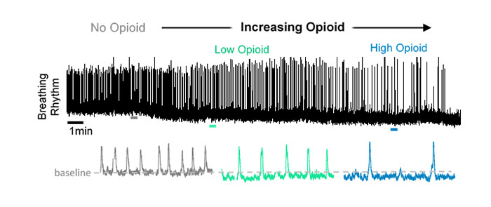 Chart showing effect of increasing opioids on breathing rhythm
