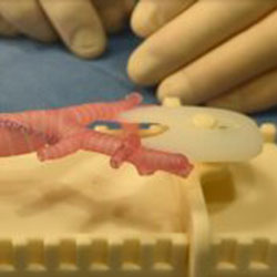 3-D printed airway model created in Seattle Children’s Innovation Lab