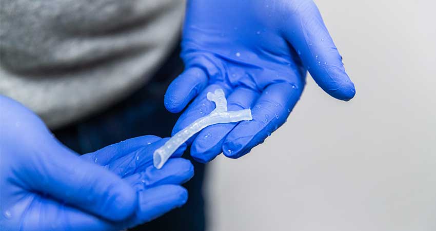 A 3D model of a tracheotomy
