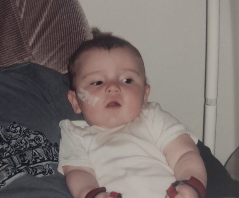 As an infant, Stage was diagnosed with a life-threatening diagnosis which causes significant muscular and neurological problems. Uncompensated Care at Seattle Children’s, funded by generous donors, helped his family focus on lifesaving care, rather than financial worries.
