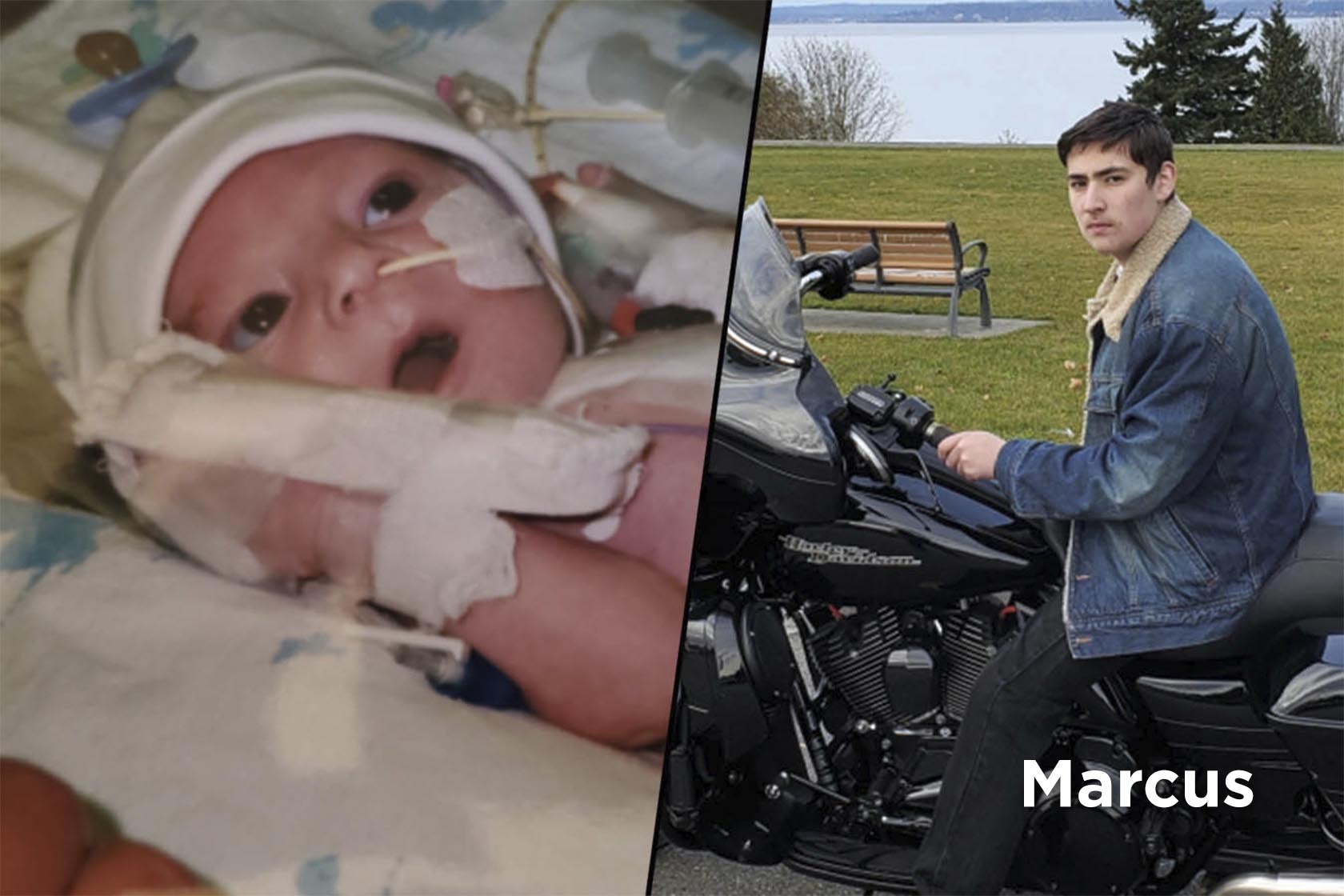 Marcus, a patient treated for a congenital heart defect, shown as a baby and as a teenager