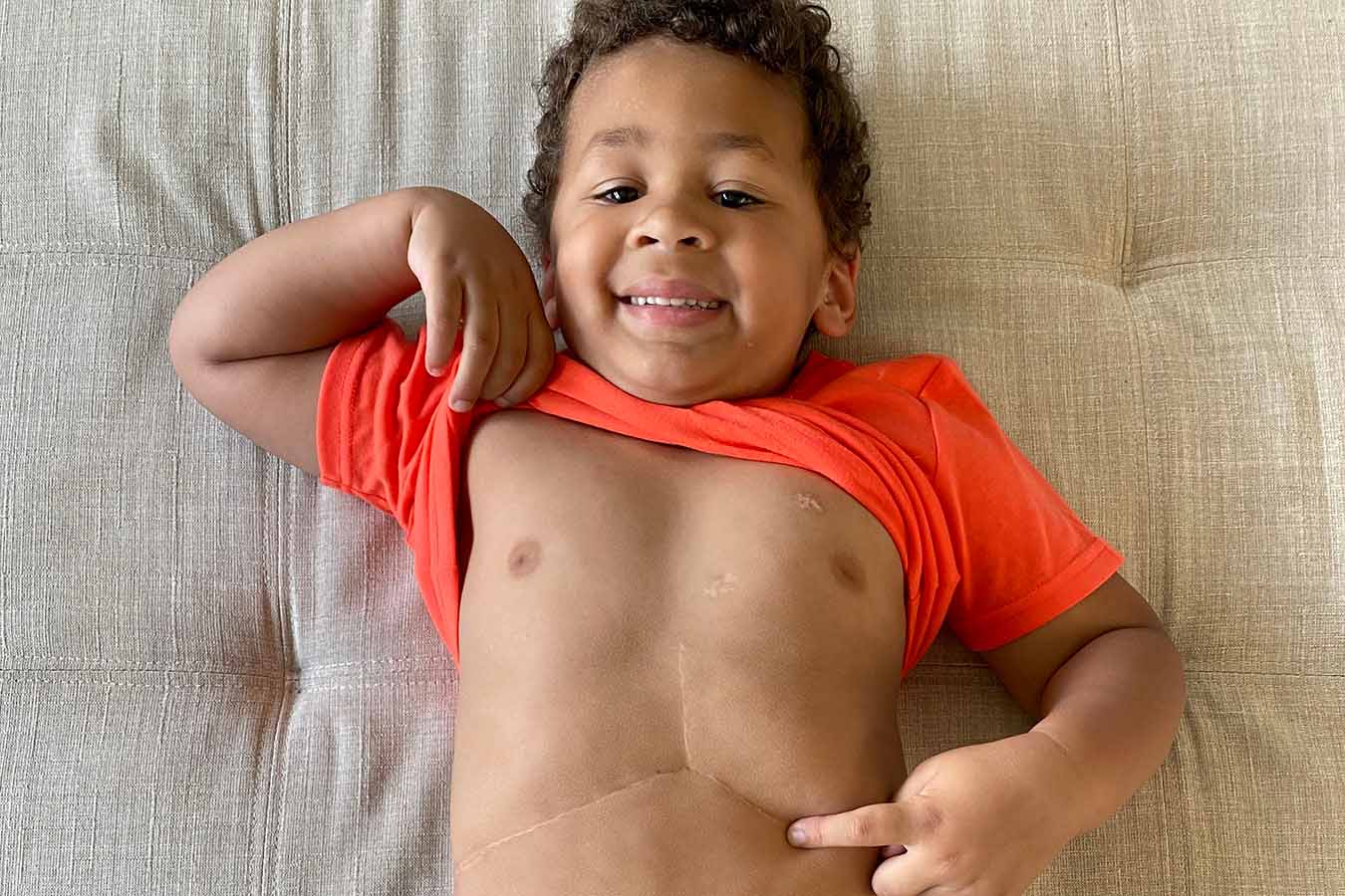 A boy proudly shows off his “Superman scar”