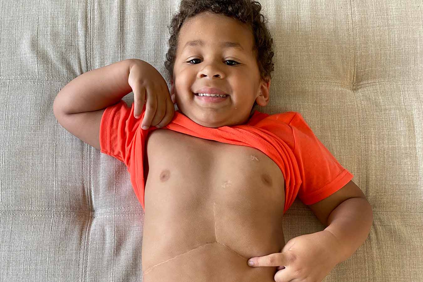 A boy proudly shows off his “Superman scar”