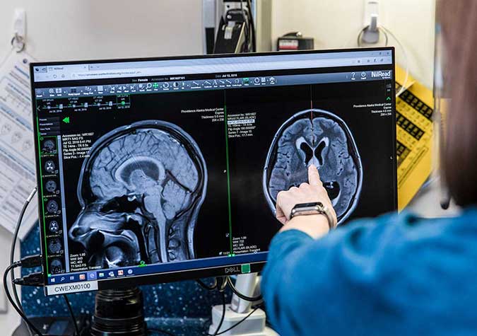 A medical researcher points to a scan of a brain