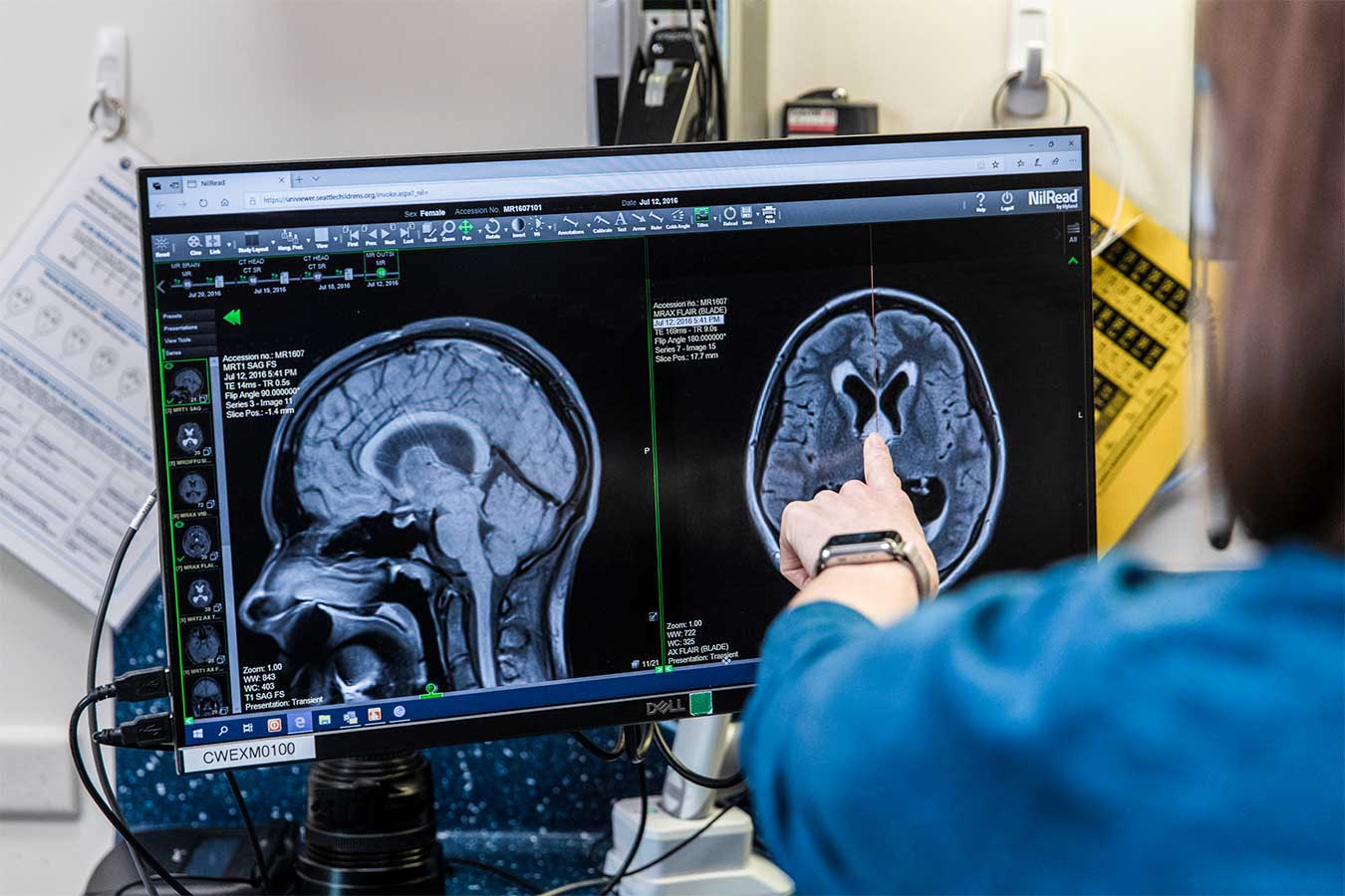 Dr Leary and Dr Hauptman examine as brain scan on a computer screen