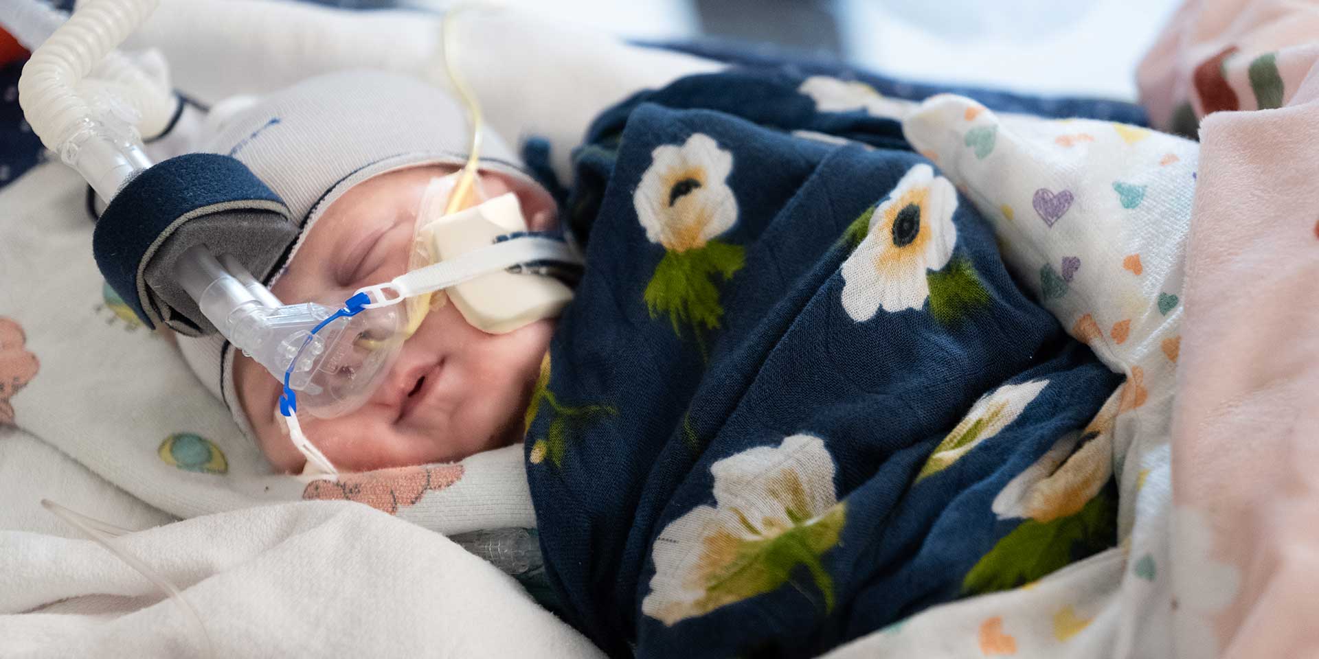 Baby receiving care in Seattle Children’s Neonatal Intensive Care Unit (NICU)