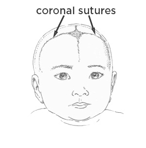 Drawing of young child showing coronal sutures in the skull