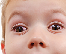 A close-up of a child's face with pick eye