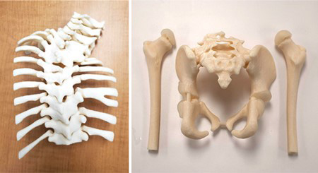A 3D-printed spine and pelvis model
