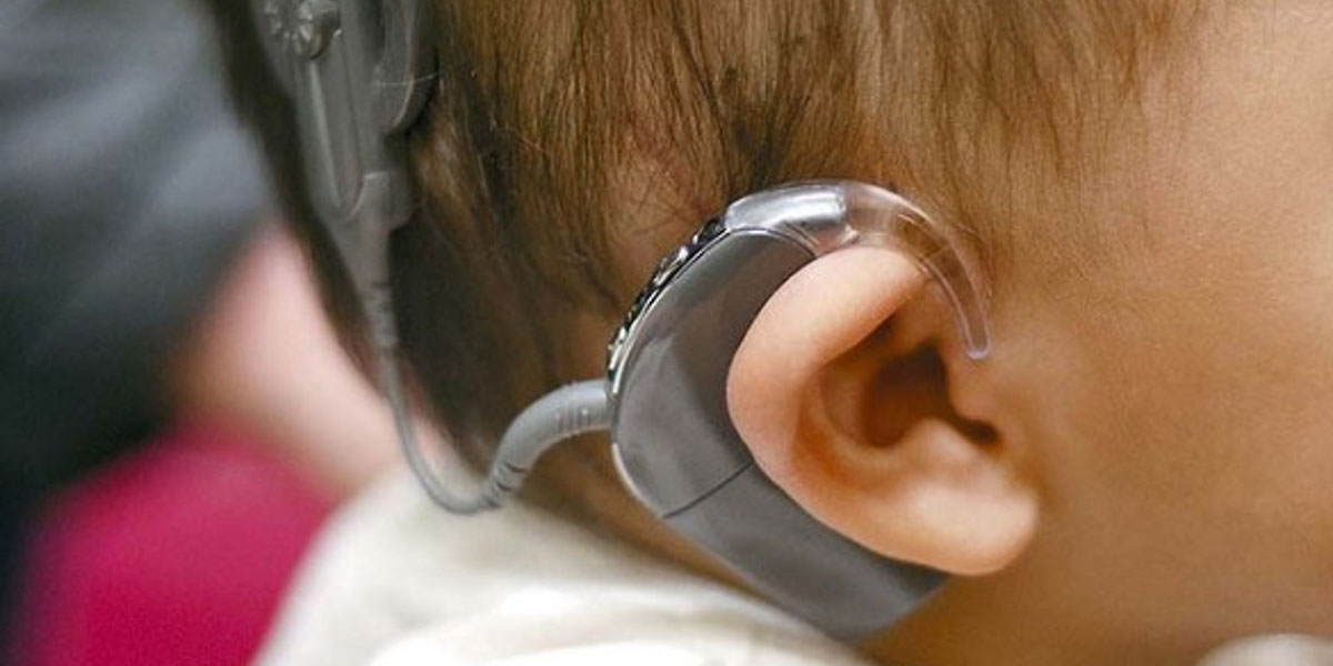 A cochlear implant on a baby's head