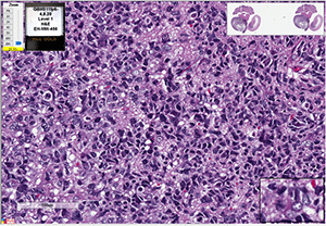 GBM-311FH cells