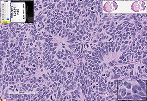 Med-813FH cells