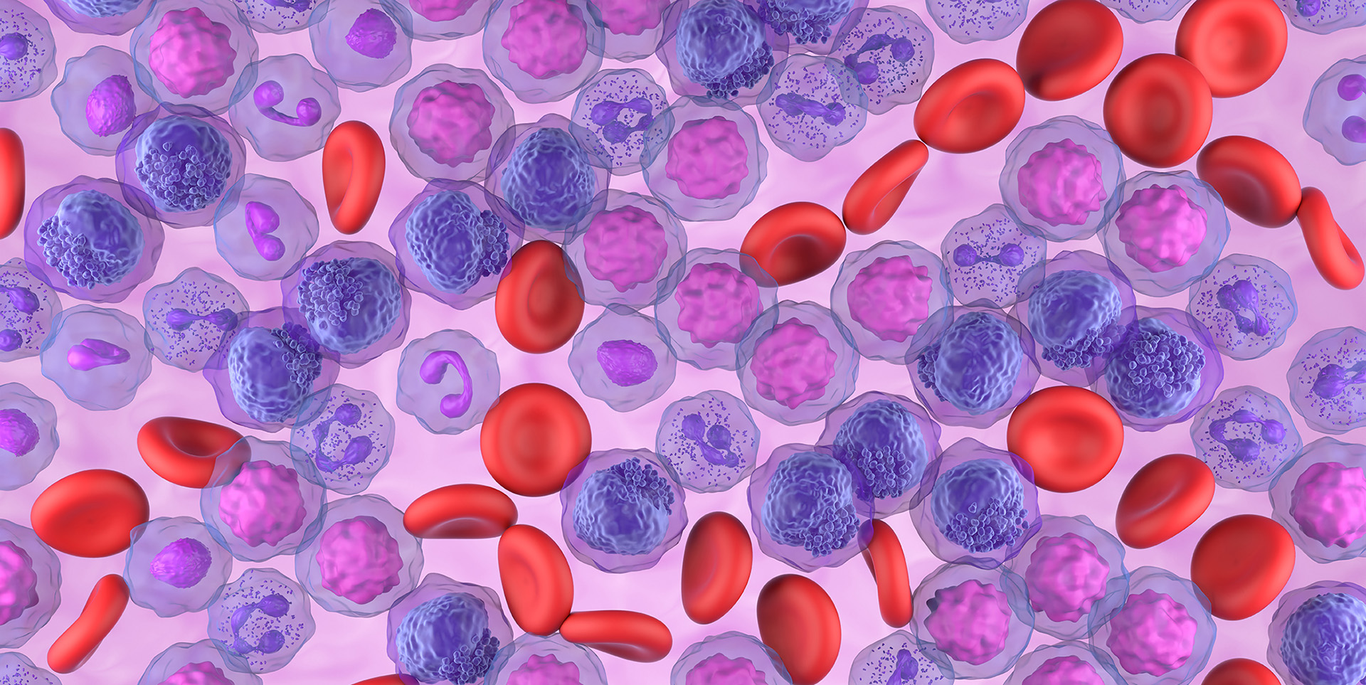AML cells