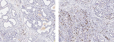 Side-by-side microscopic images of two tissue samples.