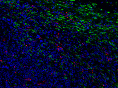 Targeting the immunosuppressive tumor microenvironment with Transform Switch Receptors 