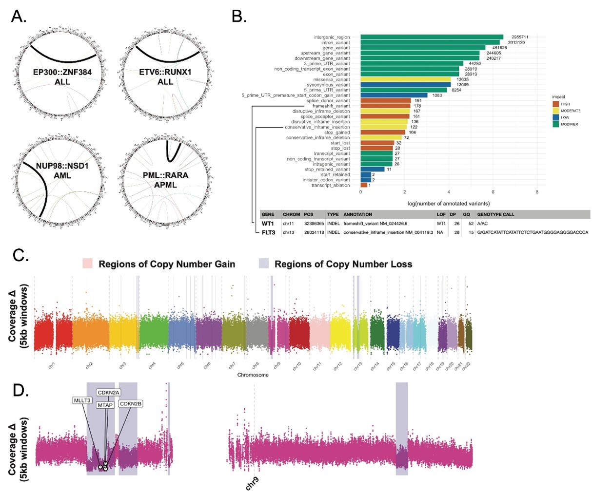 Figure 2: Accurate detection of leukemia-specific genomic lesions by LRS. A. All leukemia-defining fusions known by clinical testing were easily identified by LRS including ALL (top row) and AML/APML (bottom row) fusions.&nbsp; B. LRS identified genomic variants in an AML sample categorized by impact on protein coding. LRS identified the known WT1 and FLT3 mutations in this patient. C. Known copy number alterations across the genome. D. Zoom in on chromosome 9 showing known deletion of CDKN2A, CDKN2B and MLLT3.