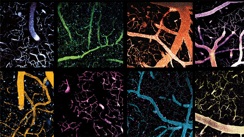 Multiple microscope images of cells