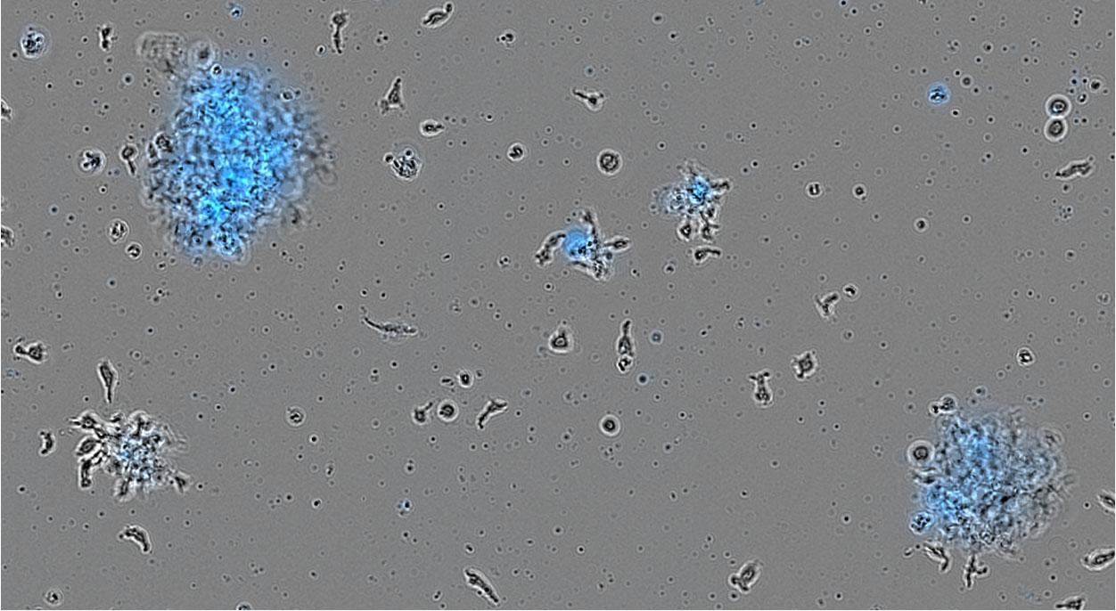 Close-up of CAR T cells