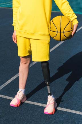 A child with a prosthetic leg holds a basketball