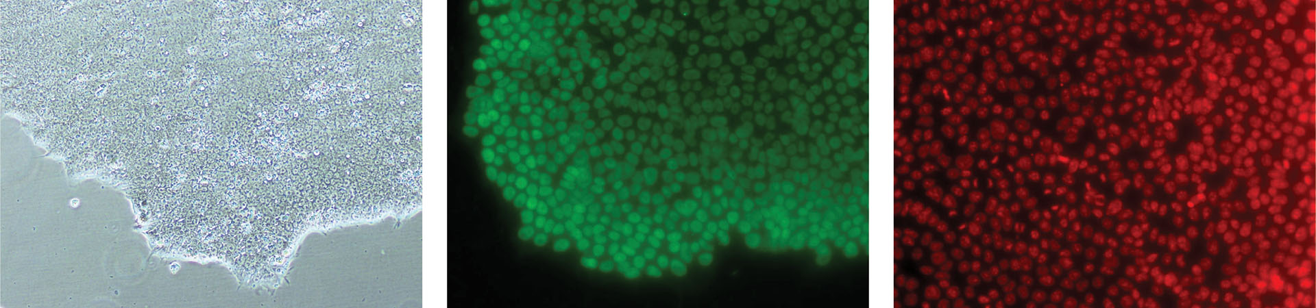 Three microscope images of cells