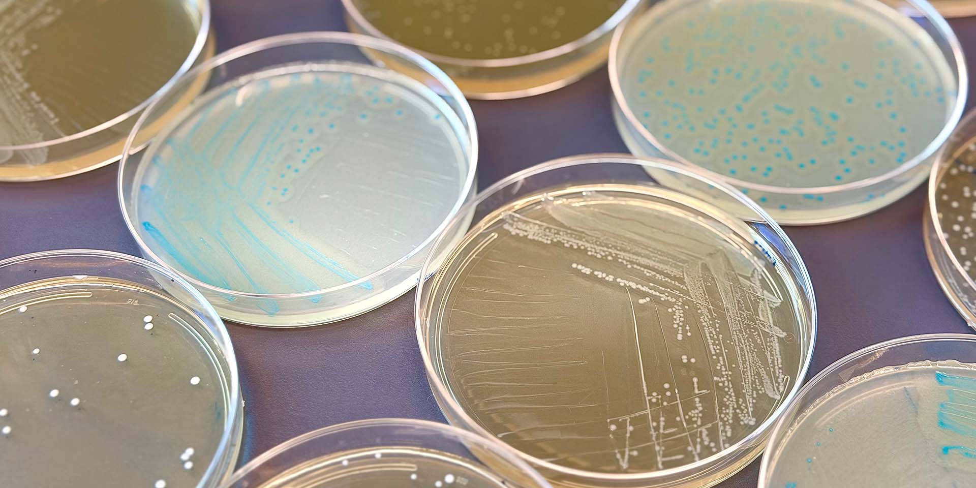 Petri dishes used in research