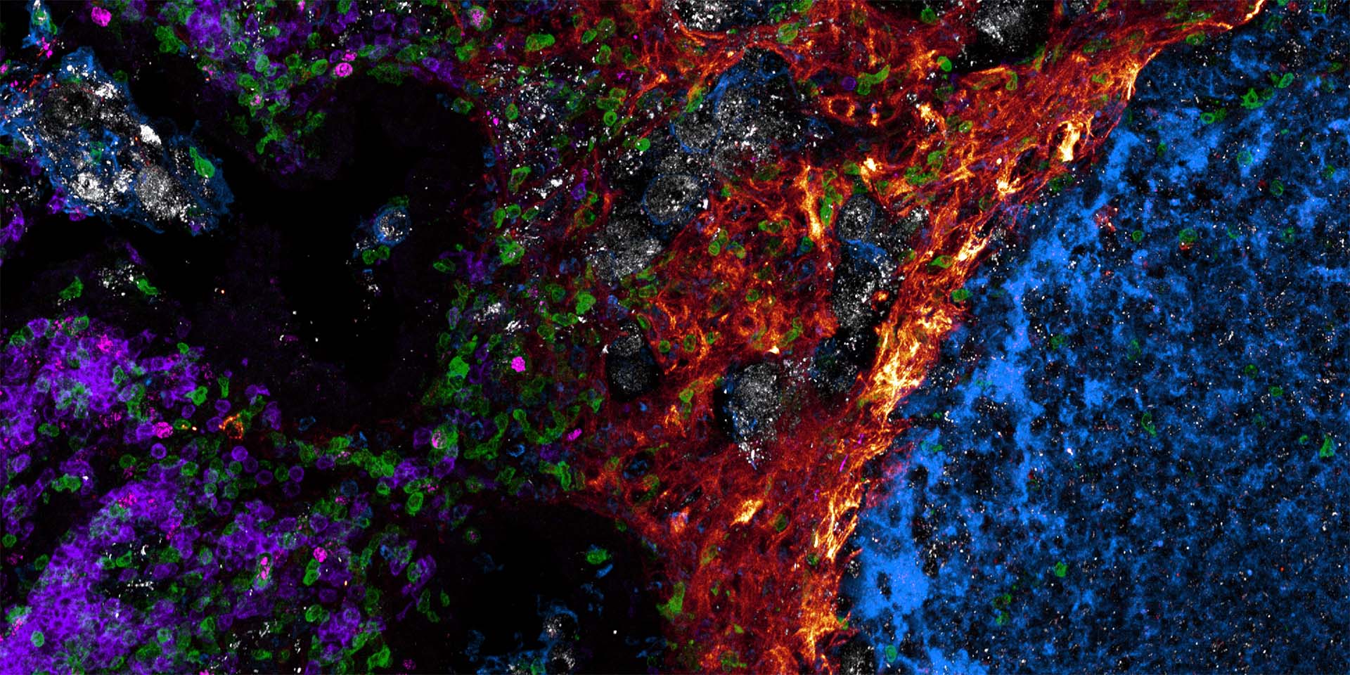 Gern Lab - Seattle Children's