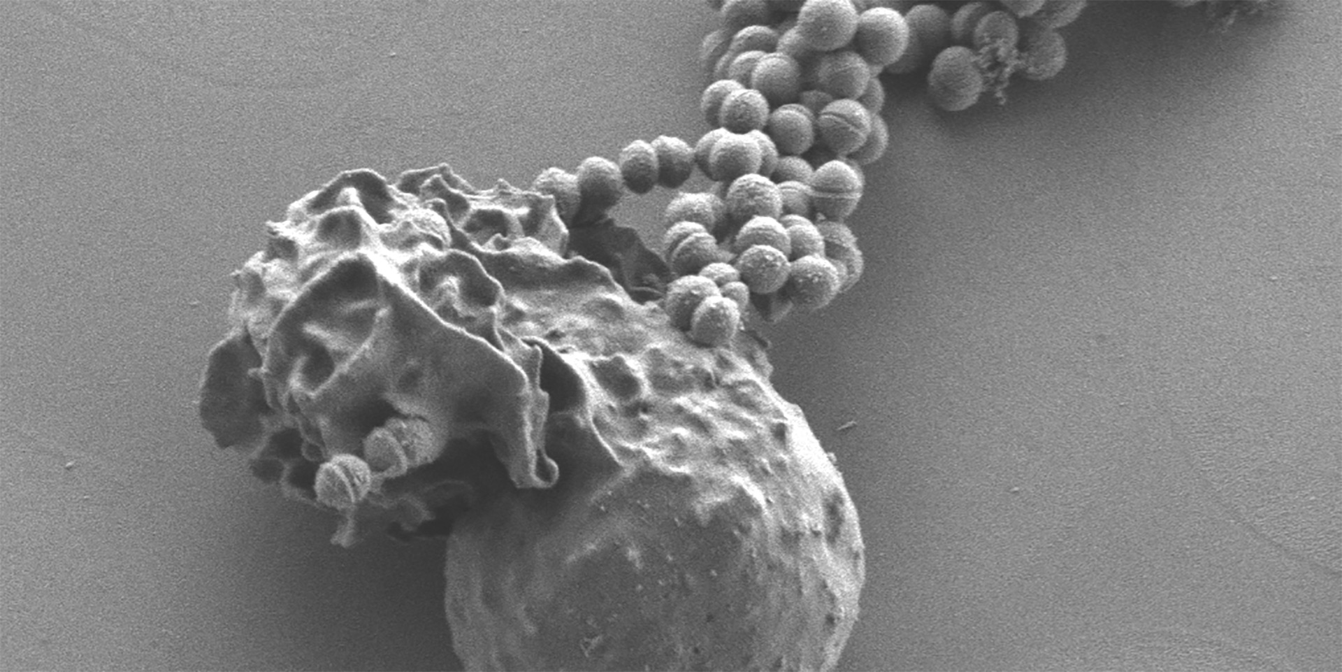 Group B Strep Interaction With Host Cells