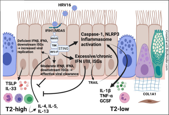 An illustration of Dysregulated asthmatic epithelial interferon responses to viruses drive exacerbation, T2 inflammation, and airway remodeling