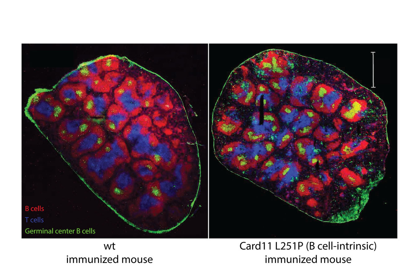 Imaging showing B cells, T cells, and Germinal center B cells of wt immunized mouse and Card11 L251P immunized mouse