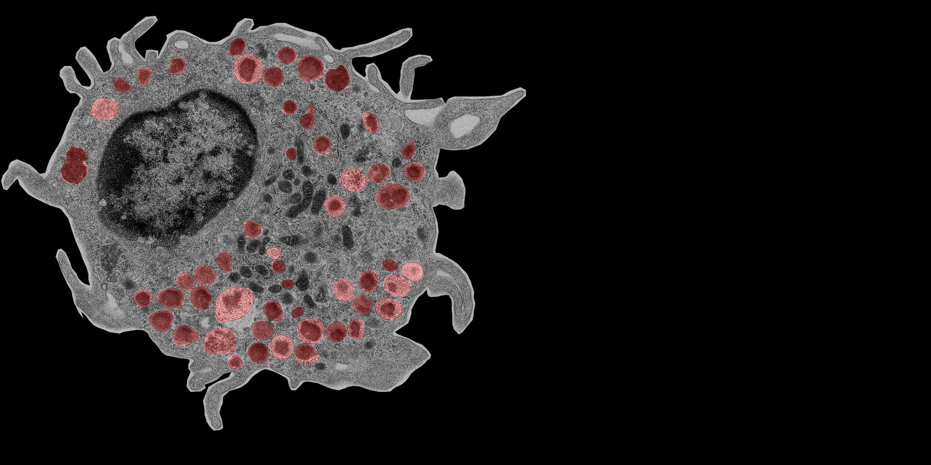 mast cell