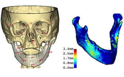 Imaging of skull and jaw