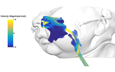 3D imaging of baby's airway showing air velocity