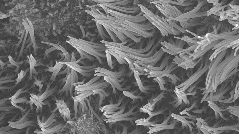 Bronchial cilia under a microscope, examining effects of viral infection