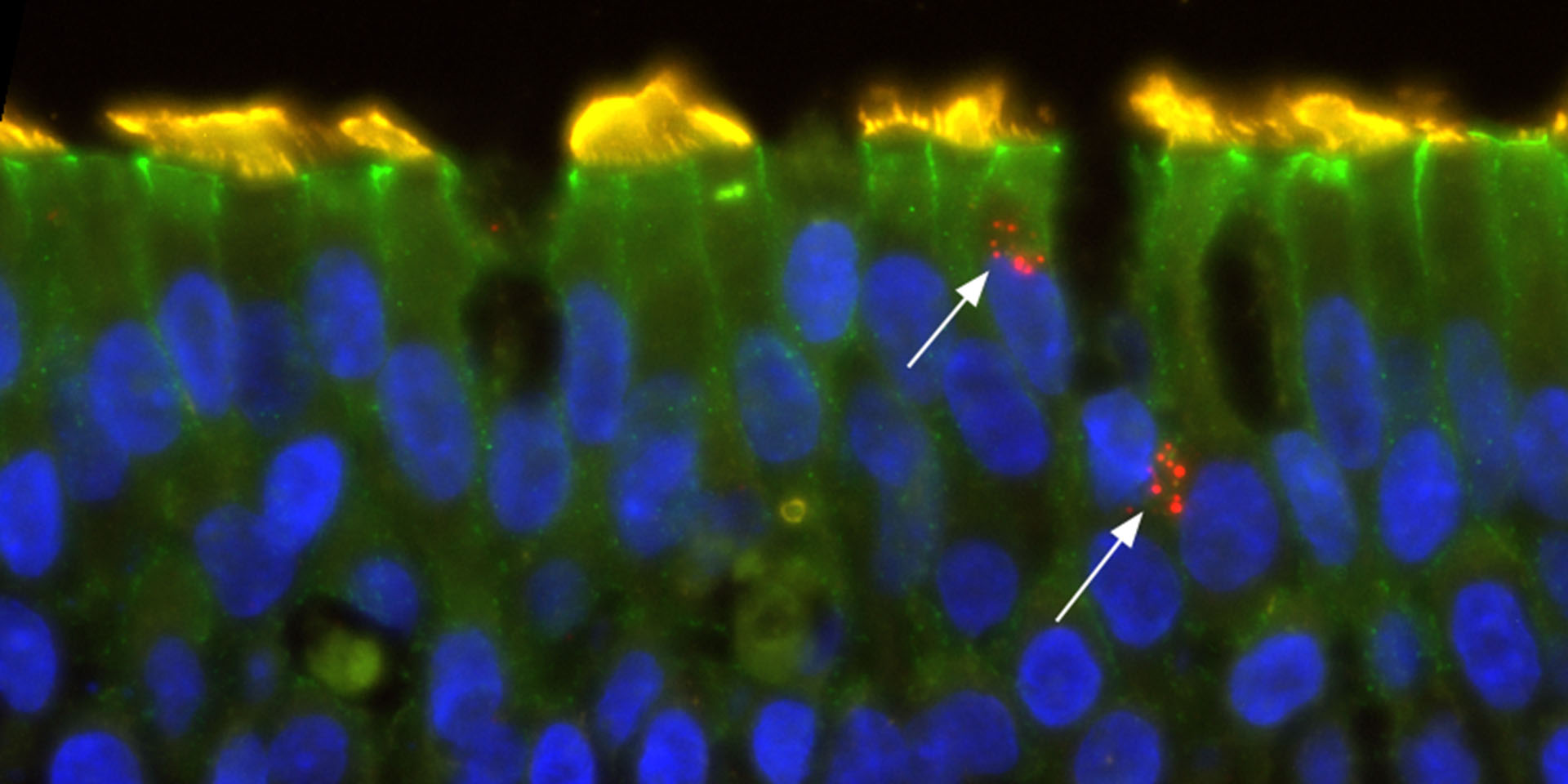 Microscope image of lung tissue
