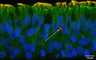 Microscope image of lung tissue