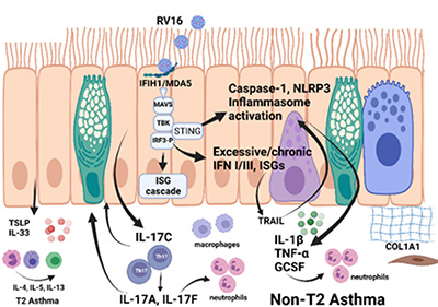 Diagram of Non-T2 Asthma