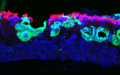 Microscope image of lung tissue