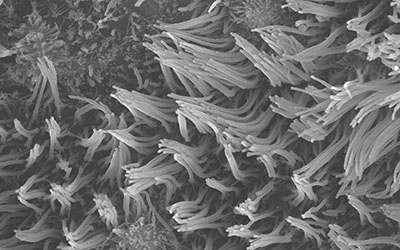 Microscope image of lung tissue