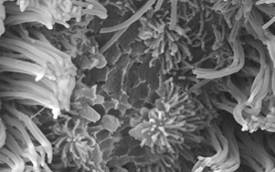 Microscope image of lung tissue