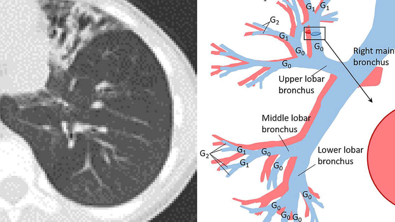 Illustration of lung