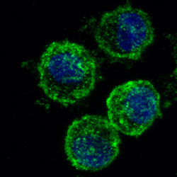 human mast cell