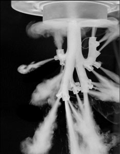 A therapeutic surfactant aerosol