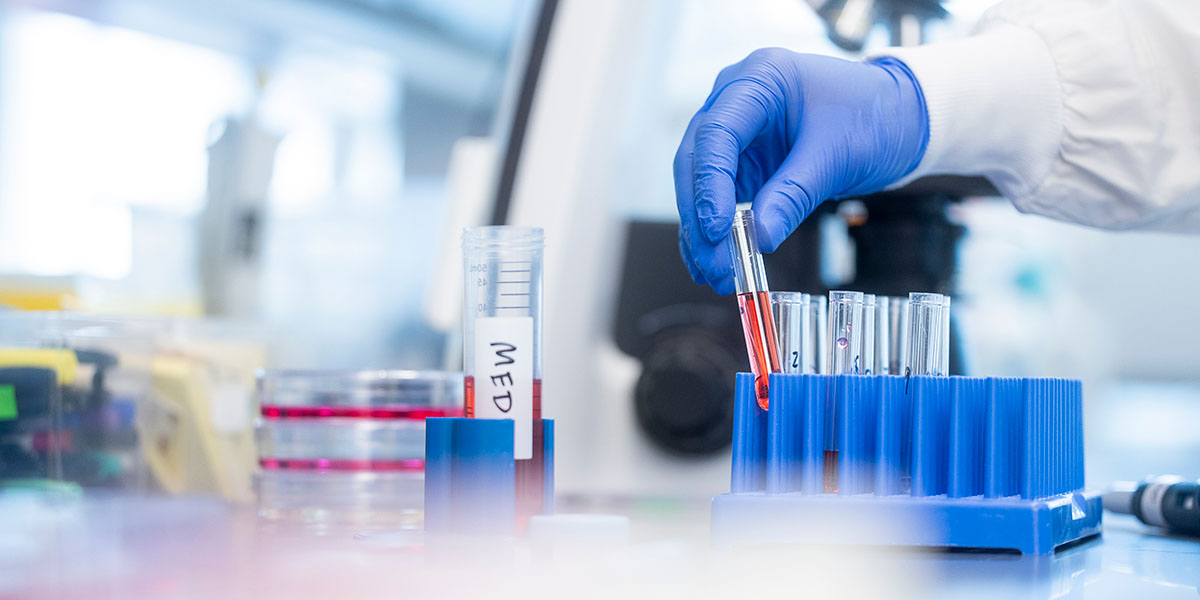 A gloved hand holding a test vial