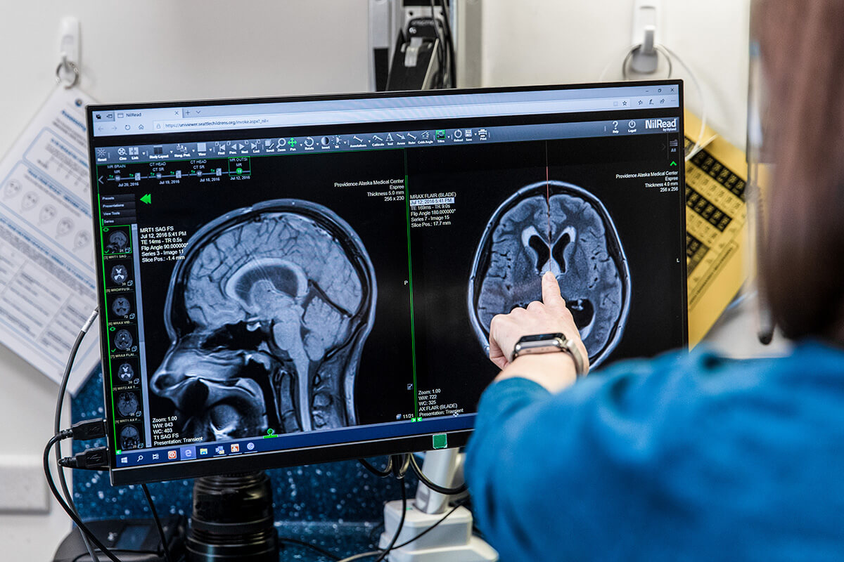 Provider looking at MRI scans on a computer