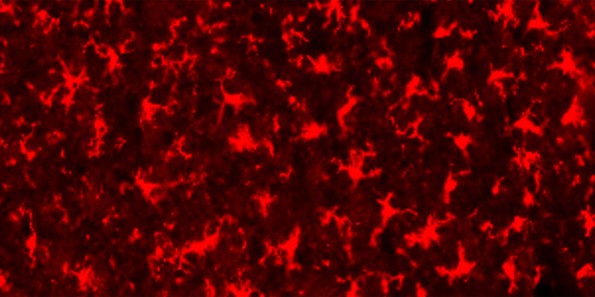 Microscopy image shows astrocytes in the breathing center of the brainstem