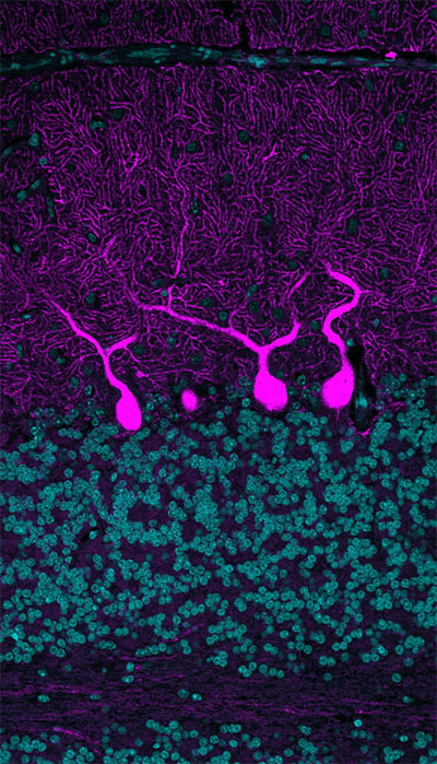 Purkinje cells in the developing human cerebellum