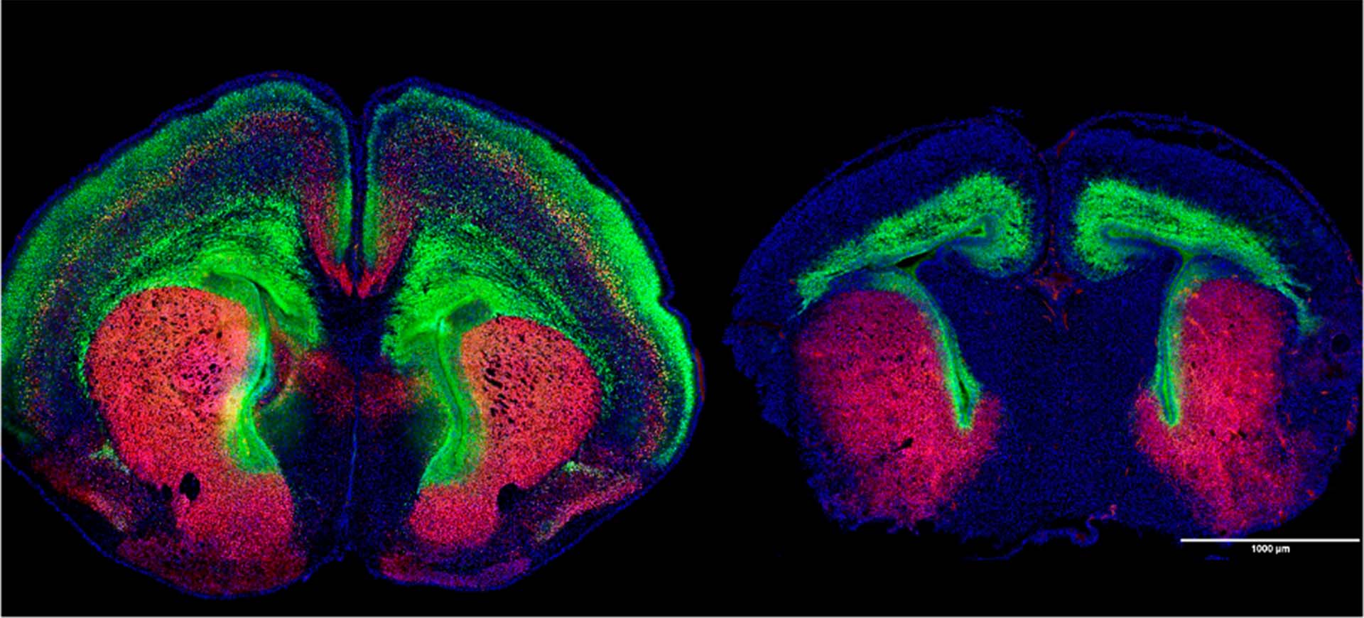 Brain scans of a typical mouse brain (left) and a mouse brain with a gene mutation that causes autism.
