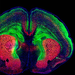 Brain scans of a typical mouse brain