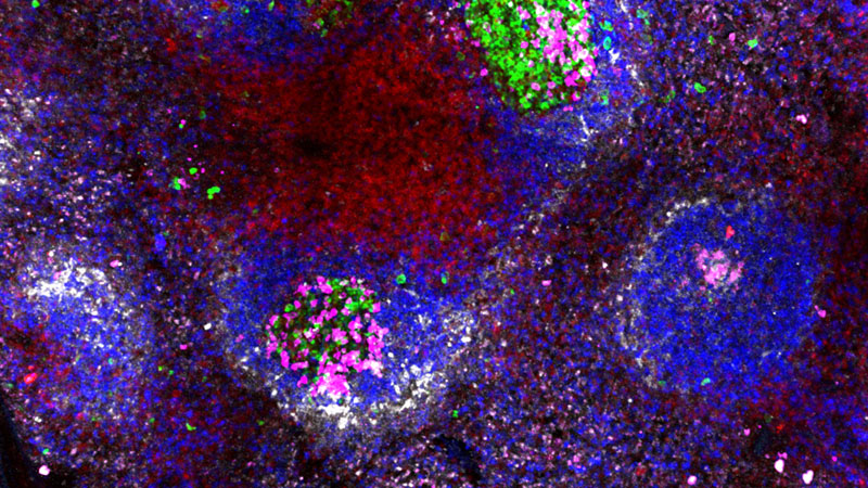 Microscopy imaging of a dissected spleen, where B cells proliferate.