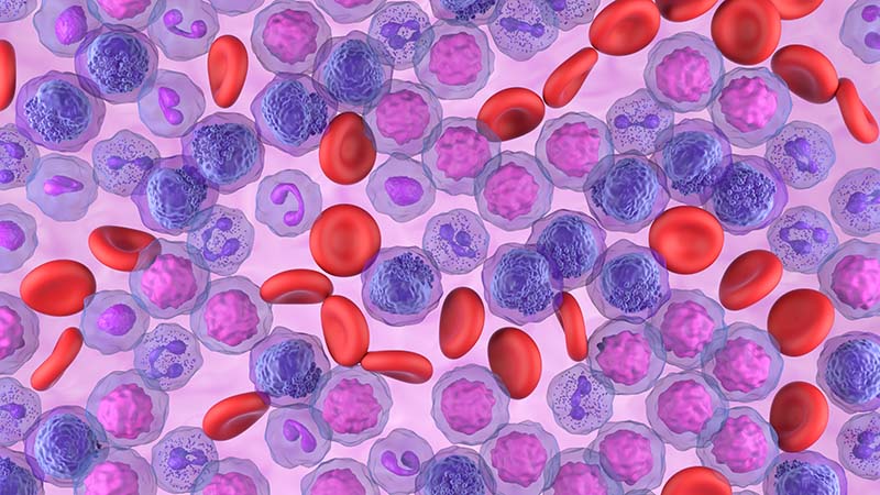 Graphic illustration of leukemia and blood cells 